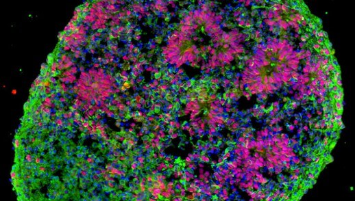 Выращенный из стволовых клеток ранний передний мозг Фото: Yale school of Medicine