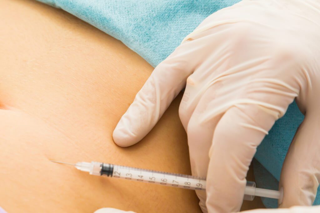 In the fight against cellulite is very effective mesotherapy. Photo: depositphotos.com